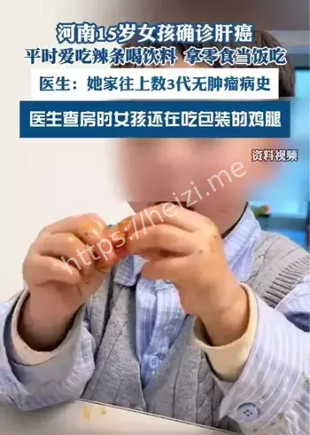 15岁女孩零食饮食肝癌案例